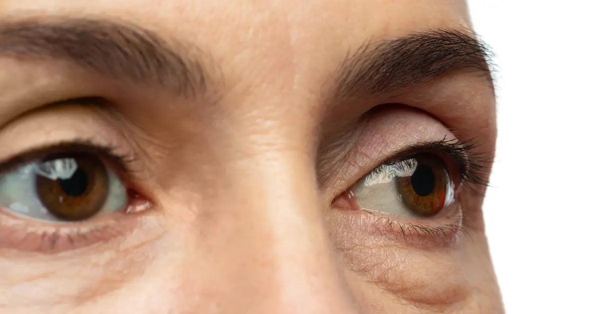 Top 5 Best Eye Creams for Puffiness & Under-Eye Bags