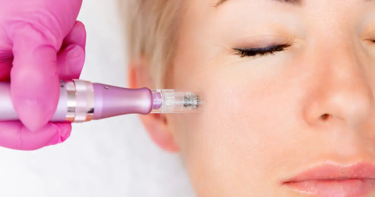 Microneedling Aftercare: 7 Things You Must Avoid for Fast Healing