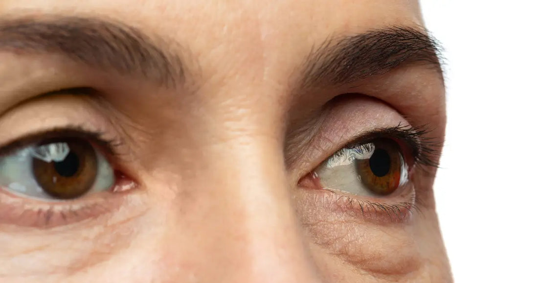 Top 5 Best Eye Creams for Puffiness & Under-Eye Bags