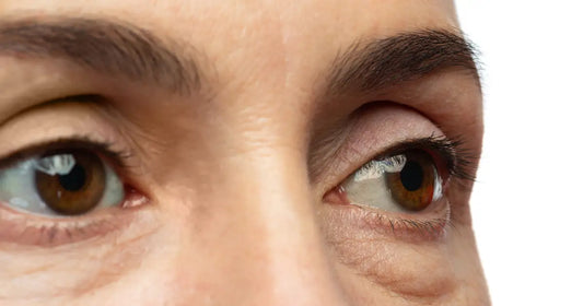 Top 5 Best Eye Creams for Puffiness & Under-Eye Bags