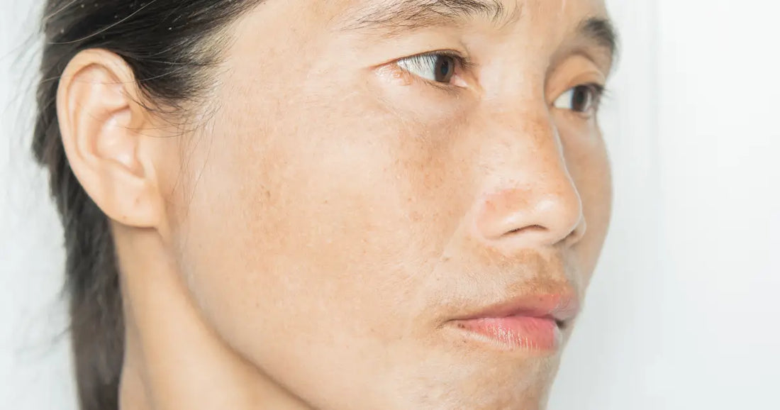 How to Hide Age Spots on Your Face: Makeup and Skincare Tips